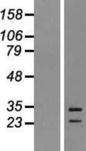 EBI3 Lysate (Adult Normal), Novus Biologicals (NBP2-07710)