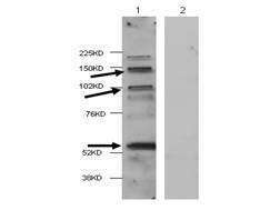 Anti-HDAC4 Rabbit Polyclonal Antibody