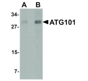 ATG101 antibody 100 µg