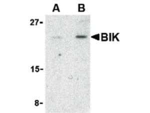 BIK antibody 100 µg