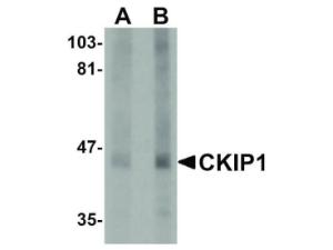 CKIP1 antibody 100 µg
