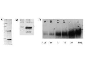 Anti-AcK Rabbit Polyclonal Antibody (HRP (Horseradish Peroxidase))