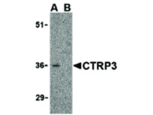 CTRP3 antibody 100 µg