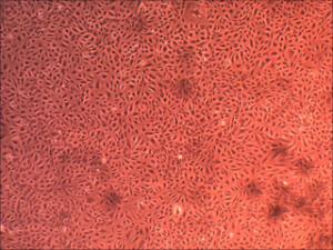 Human large intestine microvascular endothelial cells