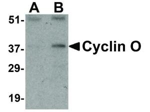 Cyclin O antibody N-term 100 µg
