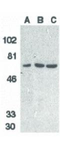 DCR1 antibody 100 µg