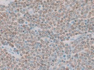 BCL-2 Oncoprotein 40X
