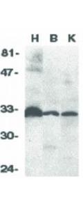 DCR3 antibody 100 µg