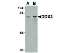 DDX3 antibody 100 µg