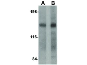 DISP2 antibody C-term 100 µg