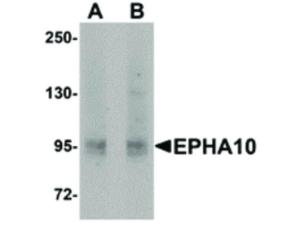 EPHA10 antibody 100 µg
