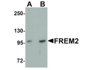 FREM2 antibody 100 µg