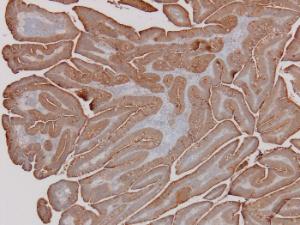 Carcinoembryonic Antigen (CEA) 4X