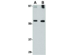 GDF6 antibody 100 µg