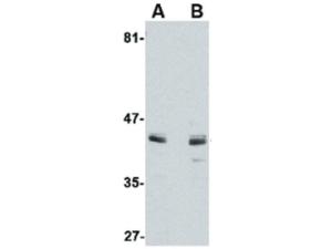 ACVR1 antibody 100 µg