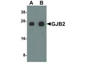 GJB2 antibody 100 µg