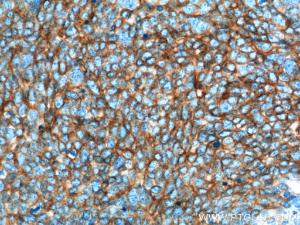 Anti-NCAM1 Mouse Monoclonal Antibody [clone: 1E8C9]