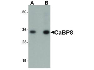 CABP8 antibody 100 µg