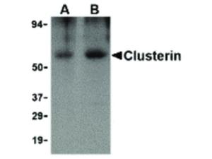 Clusterin antibody 100 µg