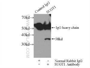 Anti-SUGT1 Rabbit Polyclonal Antibody
