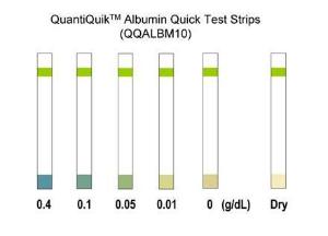 Albumin quick test strips