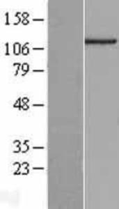 C14orf43 Lysate (Adult Normal), Novus Biologicals (NBP2-09248)