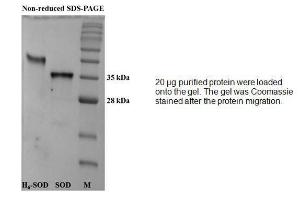 Fig 1- SDS-PAGE (15%) of purified human recombinant SOD protein.<br />Lane 1: 10  g Tagged protein<br />Lane 2: 10  g untagged protein<br />Lane 3: Marker