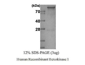 Human Recombinant Hexokinase 1 (from <i>E. coli</i>)