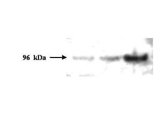 PMS2 monoclonal antibody 1 µg