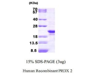 Human Recombinant PRDX2 (from <i>E. coli</i>)