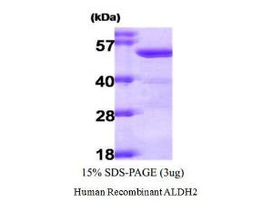 Human Recombinant ALDH2 (from <i>E. coli</i>)