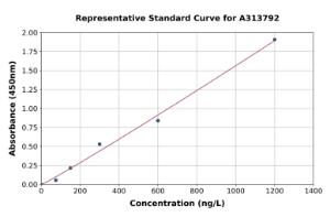 Representative standard curve for human ACSM2B ELISA kit (A313792)