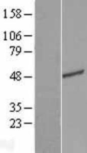 C16orf59 Overexpression Lysate (Adult Normal), Novus Biologicals (NBL1-08220)