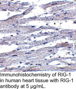 Anti-RIG-1 Rabbit Polyclonal Antibody