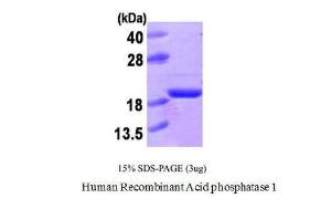 Human Recombinant Acid Phosphatase 1 (from <i>E. coli</i>)