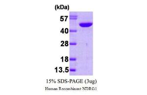 Human Recombinant NDRG1 (from <i>E. coli</i>)