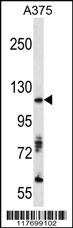 Anti-AXL Rabbit Polyclonal Antibody