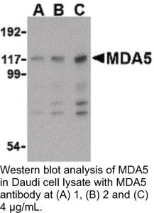 Anti-MDA5 Rabbit Polyclonal Antibody