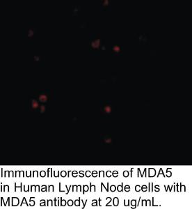 Anti-MDA5 Rabbit Polyclonal Antibody