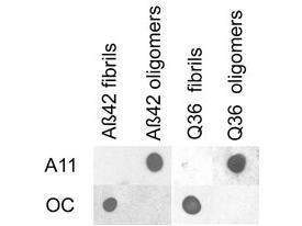 Amyloid antibody 100 µl