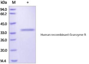 CellExp™ Human Recombinant Granzyme B (from HEK293 cells)