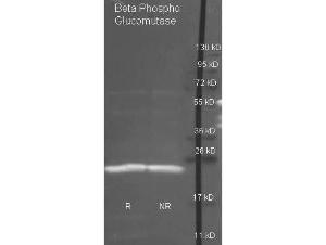 Beta PGM antibody HRP 100 µg