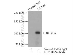 Anti-DDX58 Rabbit Polyclonal Antibody