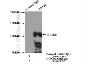 Anti-DDX58 Rabbit Polyclonal Antibody