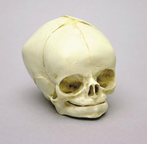 BoneClones® Fetal Skull