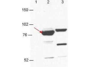 ESRP-1/2 antibody 100 µg