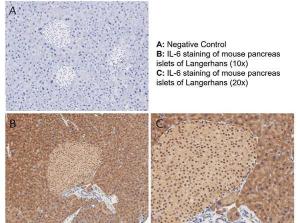 Anti-IL-6 (RP) antibody