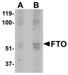 Western blot analysis of FTO in human uterus tissue lysate with FTO antibody at (A) 1 and (B) 2 ug/mL.