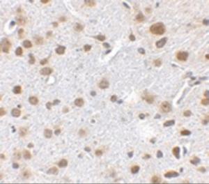 Immunohistochemistry of FTO in mouse brain tissue with FTO antibody at 2.5 µg/ml.