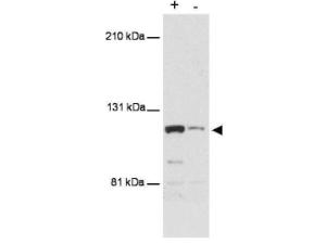 Antibody MTBP (MS) 100 µg